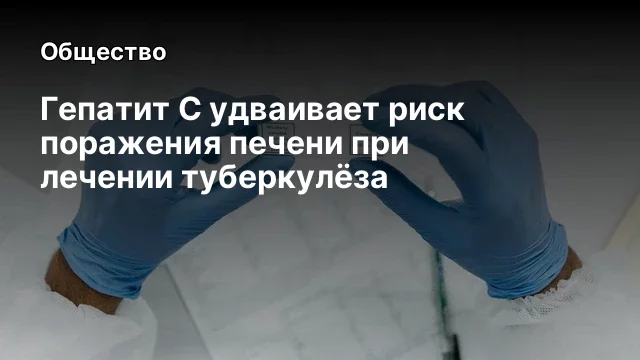 Гепатит С удваивает риск поражения печени при лечении туберкулёза