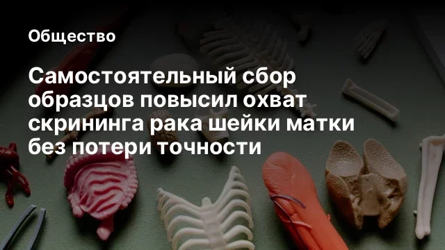 Самостоятельный сбор образцов повысил охват скрининга рака шейки матки без потери точности
