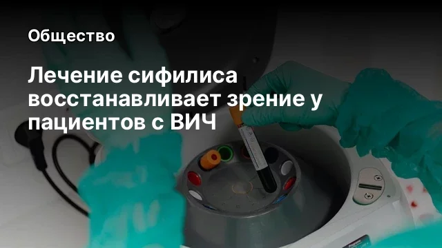 Лечение сифилиса восстанавливает зрение у пациентов с ВИЧ